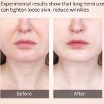 دستگاه ماساژور صورت وگردن ضد چروک ANLAN - تصویر 5